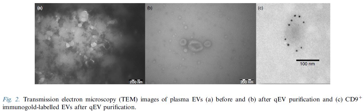 Exosome/EV 外泌體(細胞外囊泡)純化提取定量分析的全面解決方案